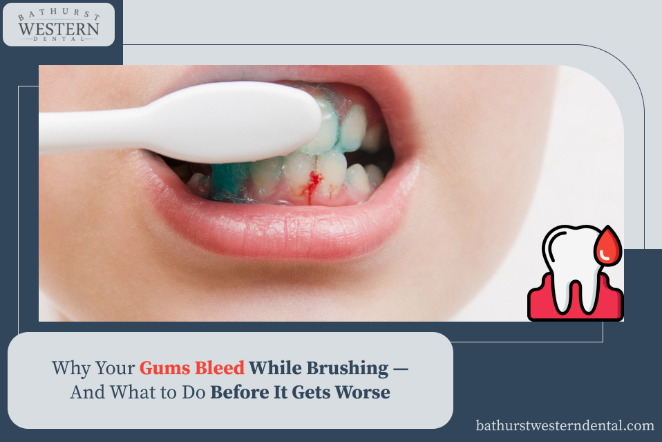 Why Your Gums Bleed When You Brush — And What to Do Before It Worsens